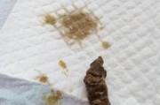 小狗便便的颜色与健康相关（揭秘小狗便便的颜色变化及其健康意义）