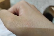 小猫疫苗的重要性（为你的小猫提供健康保护）
