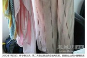 怀孕65天的身体变化及调适（孕早期的变化及注意事项）