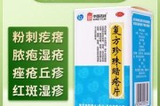 小狗身上痒吃什么药好？（探索有效缓解小狗瘙痒的药物及方法）