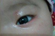 眼屎的形成原因及预防方法（揭秘眼屎的形成机制，教你如何有效预防眼屎）