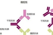 犬抗体检测的意义与应用（了解犬抗体检测的原理和优势，保障犬只健康）