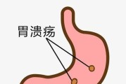 狗狗为何会打嗝？（正常现象还是疾病征兆？如何判断与应对？）