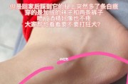 猫身上白色物质的起因及处理方法（揭秘猫身上白色物质的成分与预防措施）