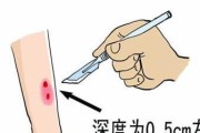 狗被蛇咬了该吃什么草药？（探寻适合狗狗的草药治疗方法）