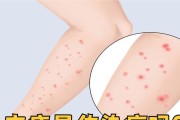 常见传染病的传播途径及防控措施（了解传染病传播途径，共同守护健康）