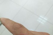 狗脸破掉痂长毛（修复狗脸伤口所需的时间和关键措施）