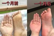 夏天容易生病的原因及预防方法（夏季养生小贴士让你远离疾病）