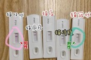 揭开狗狗线病毒的神秘面纱（了解狗狗线病毒，保护我们的宠物健康）