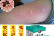 解决泰迪狗皮肤跳蚤问题的有效方法（如何为泰迪狗提供舒适无虫的生活环境）