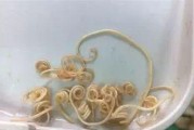 体内寄生虫（了解体内长虫的表现，保护健康生活）