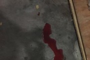 金毛狗尿血的原因及处理方法（探究金毛狗尿血的成因和有效的治疗方法）